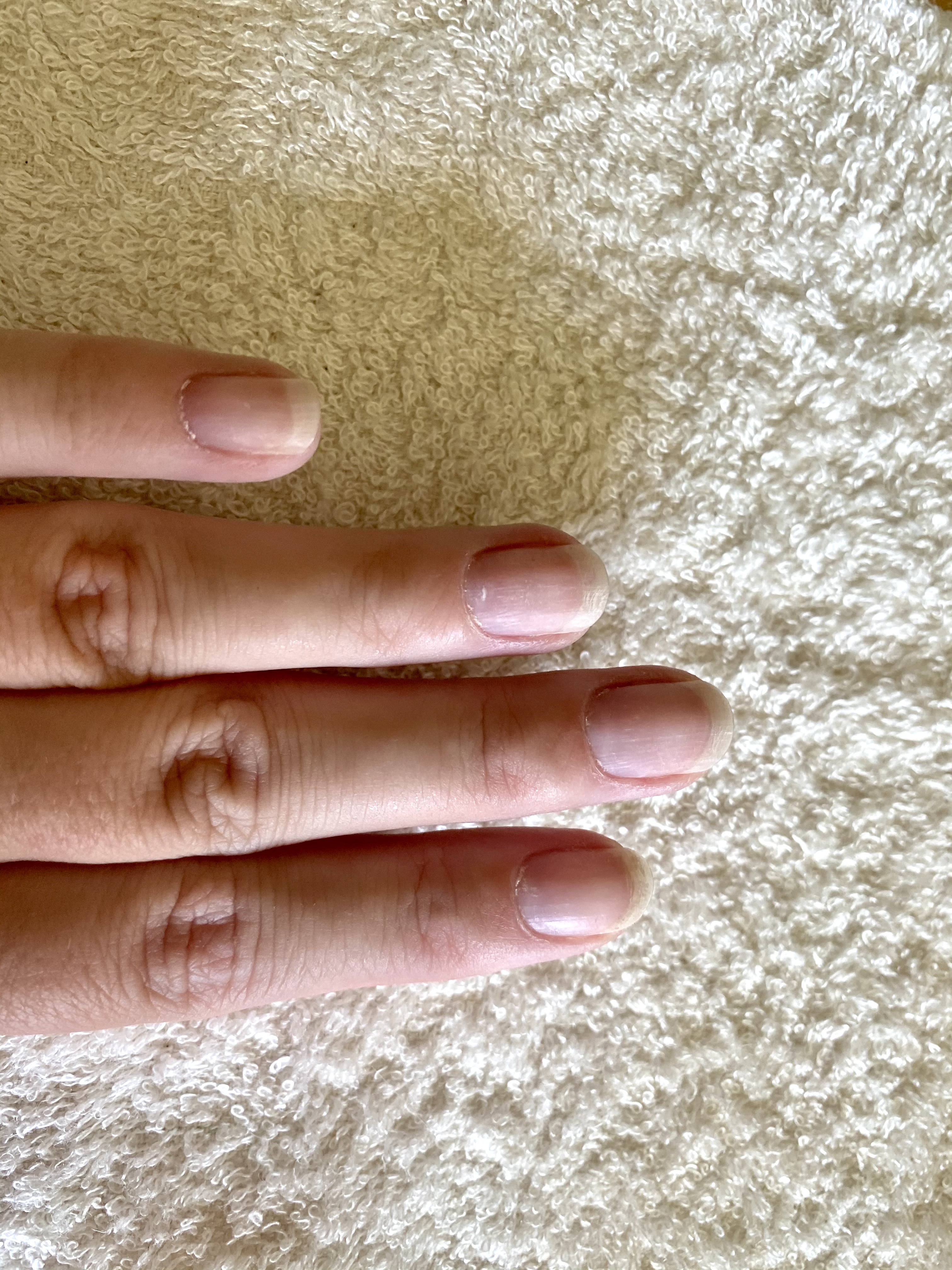 trying to kick the biting can they put gel on this easily? : r/Nails